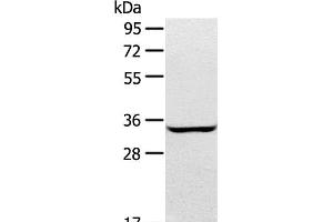 Western Blot analysis of A172 cell using STX2 Polyclonal Antibody at dilution of 1:400 (STX2 anticorps)
