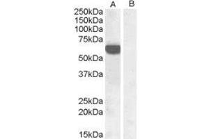 HEK293 overexpressing human IRF5 and probed with ABIN2563472 at 1ug/ml (mock transfection in lane B). (IRF5 anticorps  (C-Term))