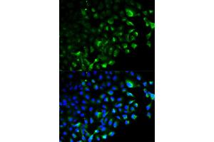 Immunofluorescence analysis of HeLa cells using TRAF2 antibody.