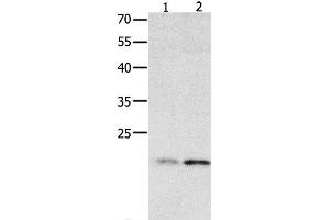 Western Blot analysis of 231 cell and Human fetal liver tissue using HMGB4 Polyclonal Antibody at dilution of 1:500 (HMGB4 anticorps)