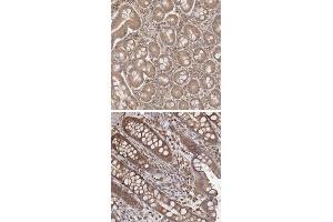 Immunohistochemical staining of human rectum with ARHGEF10L polyclonal antibody  shows strong cytoplasmic positivity. (ARHGEF10L anticorps)