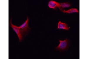 ABIN6261115 and ABIN6266521 staining Hela by IF/ICC. (Cullin 2 anticorps  (C-Term))