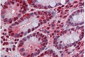 Human Small Intestine: Formalin-Fixed, Paraffin-Embedded (FFPE)