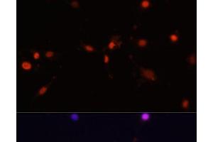 Immunofluorescence analysis of C6 cells using MCM5 Polyclonal Antibody at dilution of 1:100.