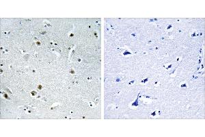 Peptide - +Immunohistochemistry analysis of paraffin-embedded human brain tissue using DDX24 antibody. (DDX24 anticorps)