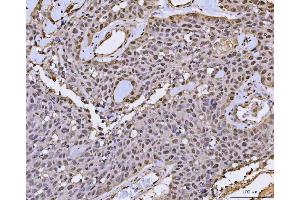IHC analysis of FIP1L1 using anti-FIP1L1 antibody (ABIN7600761). (FIP1L1 anticorps  (AA 23-558))