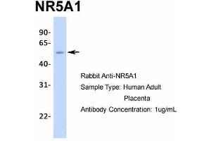 Host:  Rabbit  Target Name:  NR5A1  Sample Type:  Human Adult Placenta  Antibody Dilution:  1.