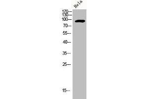 Western Blot analysis of HELA cells using Adducin α/β Polyclonal Antibody
