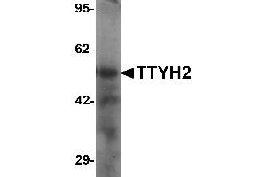 Western blot analysis of TTYH2 in human kidney tissue lysate with TTYH2 antibody at 1 µg/mL (TTYH2 anticorps  (N-Term))