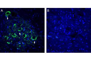Expression of Connexin-47 in rat spinal cord ventral horn region.