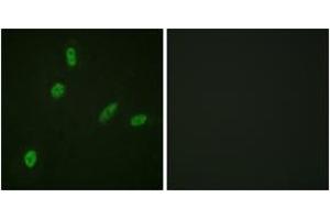 Immunofluorescence analysis of HeLa cells, using ETS1 (Ab-38) Antibody. (ETS1 anticorps  (AA 11-60))