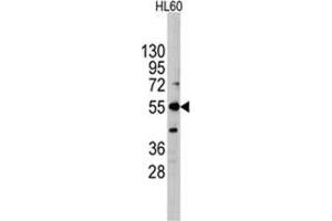 Image no. 1 for anti-Intestinal Alkaline Phosphatase (ALPI) (Center) antibody (ABIN356999) (Intestinal Alkaline Phosphatase anticorps  (Center))