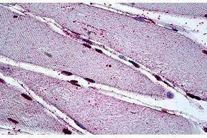 Human Skeletal Muscle: Formalin-Fixed, Paraffin-Embedded (FFPE) (MEOX2 anticorps  (AA 1-304))