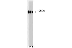 Western Blotting (WB) image for anti-Espin (ESPN) (AA 458-580) antibody (ABIN968627) (Espin anticorps  (AA 458-580))