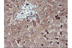 Image no. 4 for anti-serpin Peptidase Inhibitor, Clade B (Ovalbumin), Member 1 (SERPINB1) (AA 77-306) antibody (ABIN1491671)