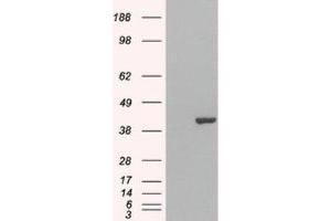 Western Blotting (WB) image for anti-GRB2-Related Adaptor Protein 2 (GRAP2) (C-Term) antibody (ABIN2465791) (GRAP2 anticorps  (C-Term))