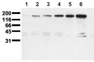 Western Blotting (WB) image for anti-Receptor tyrosine-protein kinase erbB-2 (ErbB2/Her2) (pSer1113) antibody (ABIN126790) (ErbB2/Her2 anticorps  (pSer1113))