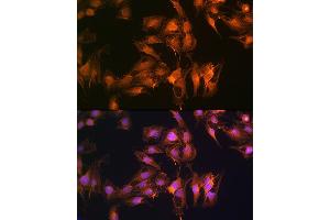 Immunofluorescence analysis of C6 cells using S100 Rabbit pAb (ABIN6128693, ABIN6147339, ABIN6147340 and ABIN6214636) at dilution of 1:100 (40x lens).