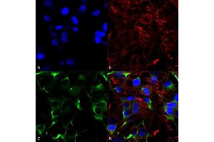 Immunocytochemistry/Immunofluorescence analysis using Mouse Anti-SNAT1 Monoclonal Antibody, Clone S104-32 (ABIN2482510).