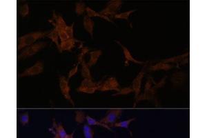Immunofluorescence analysis of HeLa cells using SERPINB9 Polyclonal Antibody at dilution of 1:100.