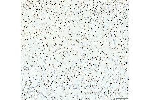 IHC analysis of HDAC2 using anti-HDAC2 antibody (ABIN7601564). (HDAC2 anticorps  (AA 387-488))