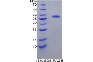 SDS-PAGE analysis of Rat Dopamine Receptor D2 Protein.
