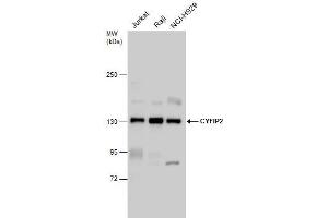 WB Image CYFIP2 antibody detects CYFIP2 protein by western blot analysis. (CYFIP2 anticorps)