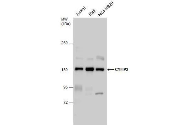 CYFIP2 anticorps