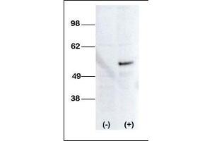 Western blot analysis of anti-STK38L Pab transiently transfected HEK-293 cell line lysate (1ug/lane). (STK38L anticorps  (C-Term))