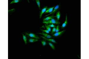 Immunofluorescence staining of Hela cells with ABIN7160013 at 1:266, counter-stained with DAPI. (JNK2 anticorps  (AA 1-424))