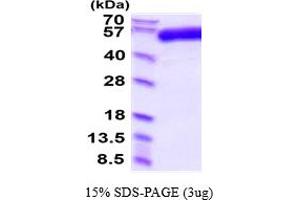 SDS-PAGE (SDS) image for Transforming Growth Factor, beta Receptor II (70/80kDa) (TGFBR2) (AA 23-166) protein (hIgG-His-tag) (ABIN7281126)