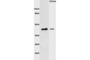 Lane 1: mouse kidney lysates probed with Anti PTGER1 Polyclonal Antibody, Unconjugated (ABIN872820) at 1:200 in 4 °C. (PTGER1 anticorps  (AA 61-160))