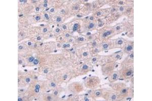 Figure. (IGFBP3 anticorps)