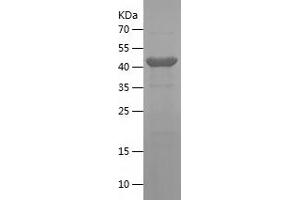Western Blotting (WB) image for Intercellular Adhesion Molecule 1 (ICAM1) (AA 26-272) protein (His-IF2DI Tag) (ABIN7123480)