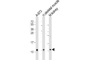 anti-NADH Dehydrogenase (Ubiquinone) 1 alpha Subcomplex, 1, 7.5kDa (NDUFA1) (AA 26-59) antibody