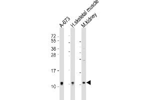 All lanes : Anti-NDUFA1 Antibody (Center) at 1:2000 dilution Lane 1: A-673 whole cell lysate Lane 2: human skeletal muscle lysate Lane 3: mouse kidney lysate Lysates/proteins at 20 μg per lane. (NDUFA1 anticorps  (AA 26-59))
