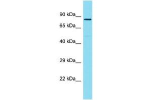 Host: Rabbit Target Name: ZYG11A Sample Type: Hela Whole Cell lysates Antibody Dilution: 1. (ZYG11A anticorps  (C-Term))