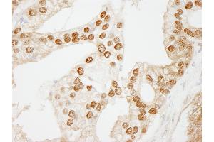 Immunohistochemistry (IHC) image for anti-WD Repeat Domain 77 (WDR77) (AA 292-342) antibody (ABIN7449034) (WDR77 anticorps  (AA 292-342))