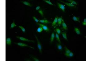Immunofluorescence staining of Hela cells with ABIN7158776 at 1:166, counter-stained with DAPI. (PRCP anticorps  (AA 347-443))