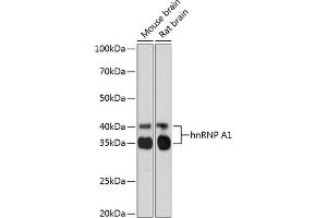 Western blot analysis of extracts of various cell lines, using hnRNP  Rabbit mAb (1564) at 1:1000 dilution. (HNRNPA1 anticorps)