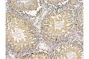 ABIN7096225 and ABIN7100287 at 1/100 staining rat testis tissue by IHC-P. (DSCR3 anticorps)