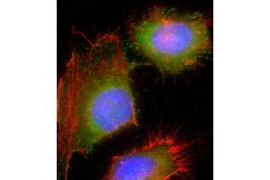 Immunofluorescent analysis of 4 % paraformaldehyde-fixed, 0.