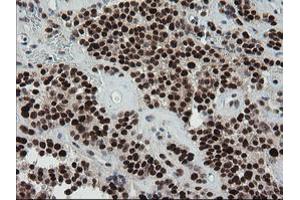 Image no. 6 for anti-tRNA Methyltransferase 2 Homolog A (TRMT2A) antibody (ABIN1501516)