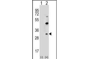 Western blot analysis of CLDN2 (arrow) using rabbit polyclonal CLDN2 Antibody  (ABIN656563 and ABIN2845823). (Claudin 2 anticorps  (C-Term))