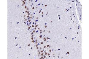 Immunohistochemistry analysis of paraffin-embedded Rat brain using c-Fos Polyclonal Antibody at dilution of 1:200. (c-FOS anticorps)