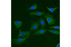 IF analysis of TRIM25 using anti-TRIM25 antibody (ABIN7599495). (TRIM25 anticorps  (AA 1-610))