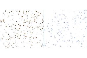 Immunocytochemistry (ICC) image for anti-gamma Histone Variant H2AX (GAMMA-H2AX) (Ser140) antibody (ABIN7449557) (gamma H2AX anticorps  (Ser140))