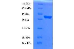SDS-PAGE (SDS) image for Ropporin, Rhophilin Associated Protein 1B (ROPN1B) (AA 1-120) protein (GST tag) (ABIN5710266)