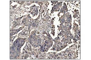 IHC analysis of DHPS/DHS using anti-DHPS/DHS antibody (ABIN7601998). (DHPS anticorps  (AA 54-358))