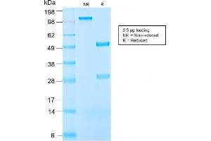 SDS-PAGE Analysis Purified IGF-1 Rabbit Recombinant Monoclonal Anitbody (IGF1/2872R). (Recombinant IGF1 anticorps)